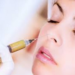 Phẫu thuật cấy mỡ làm đầy vùng mặt