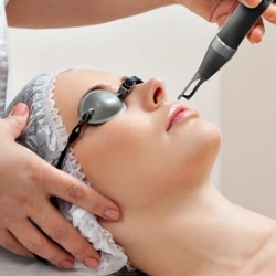 Laser điều trị nếp nhăn