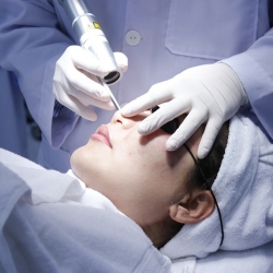 Laser điều trị u da